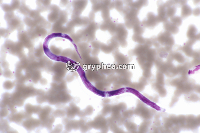 Microfilaire dans le sang (larve de nématode) x200 - gryphea.org